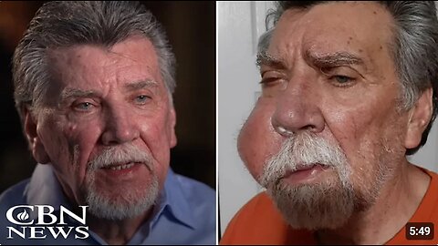 God Supernaturally Healed This Man of Inoperable Cancer When Chemo Wasn't an Option