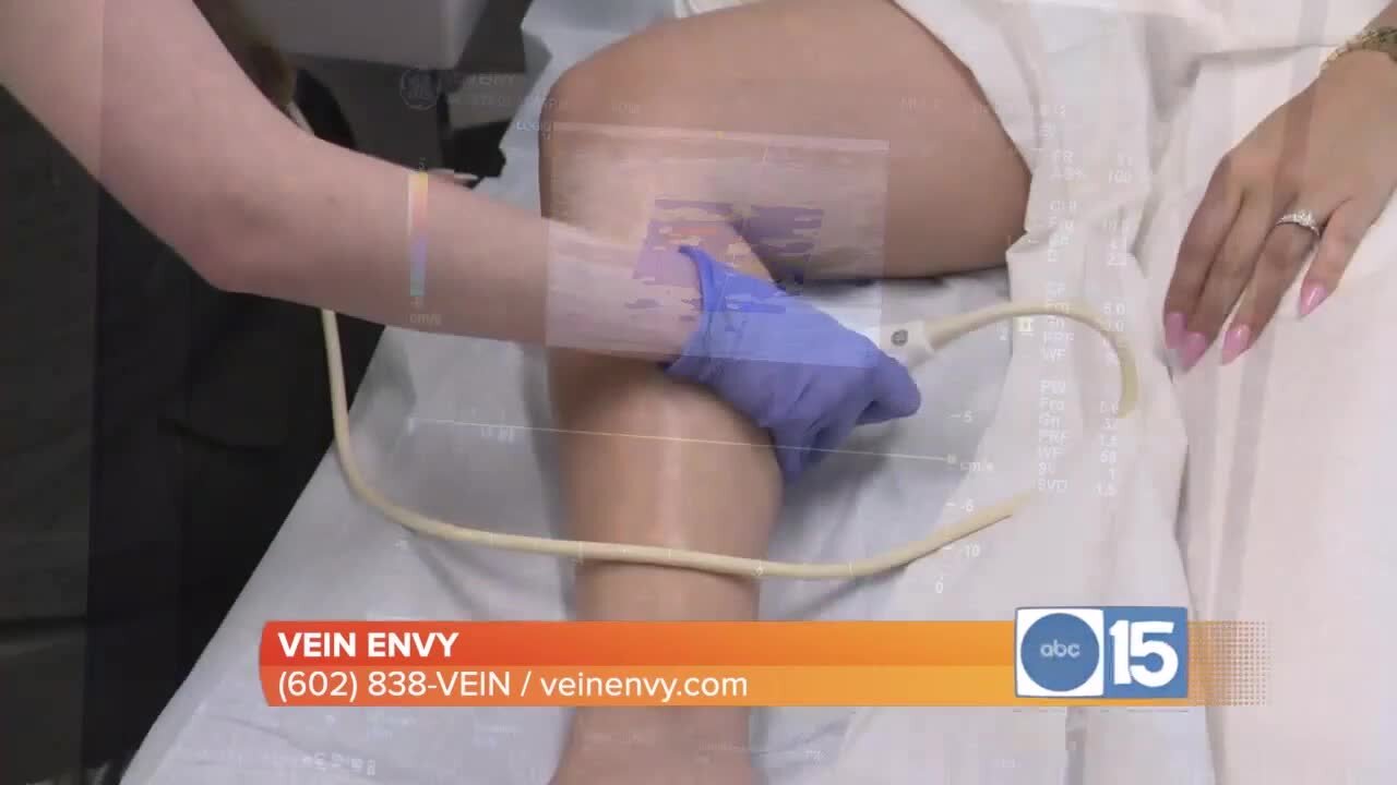 Vein Envy: Advanced, minimally invasive techniques to treat vein disease