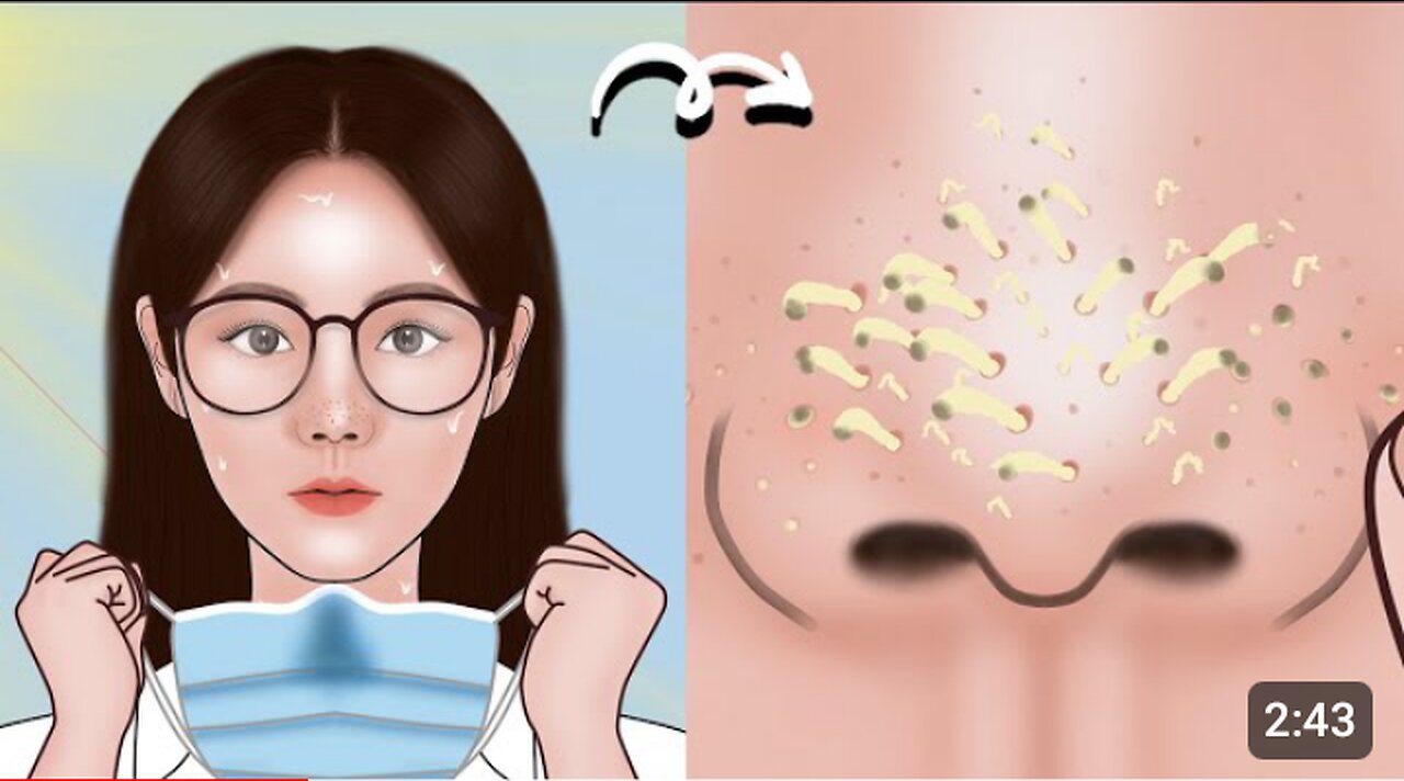 Satisfying Full Blackhead Treatment At Home! ASMR skincare animation丨Meng's Stop Motion