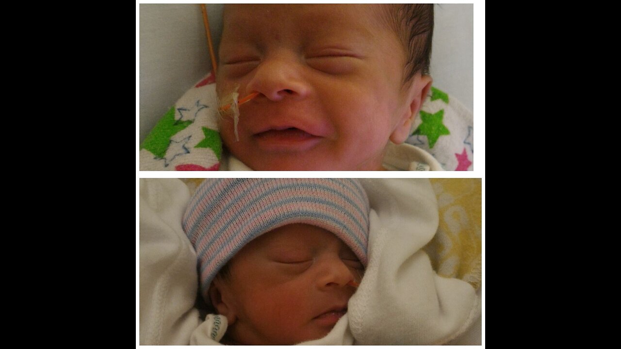 Preemie Baby Twins Born at 29 Weeks - Their NICU Birth Story