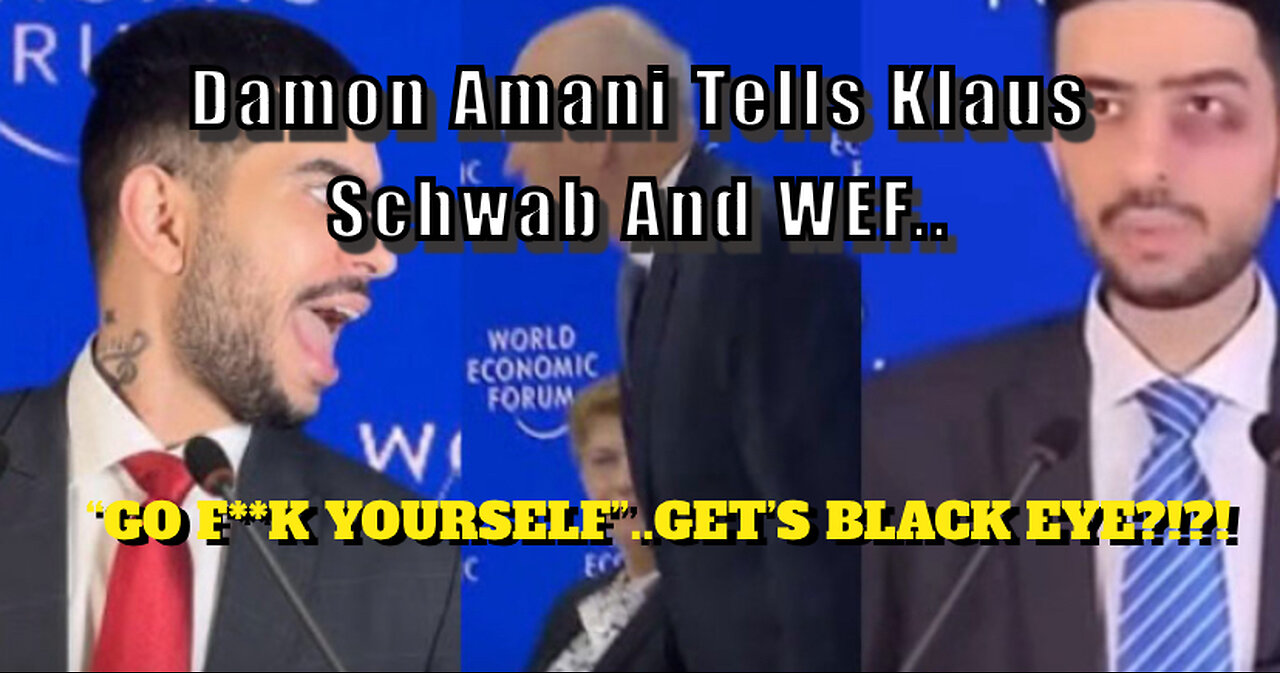 Damon Imani tells Klaus Schwab and WEF “Go F**K yourself.. Get’s a Black Eye!?!?