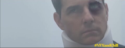 Mission Impossible: In Hospital | Official Trailer | Tom Cruise |