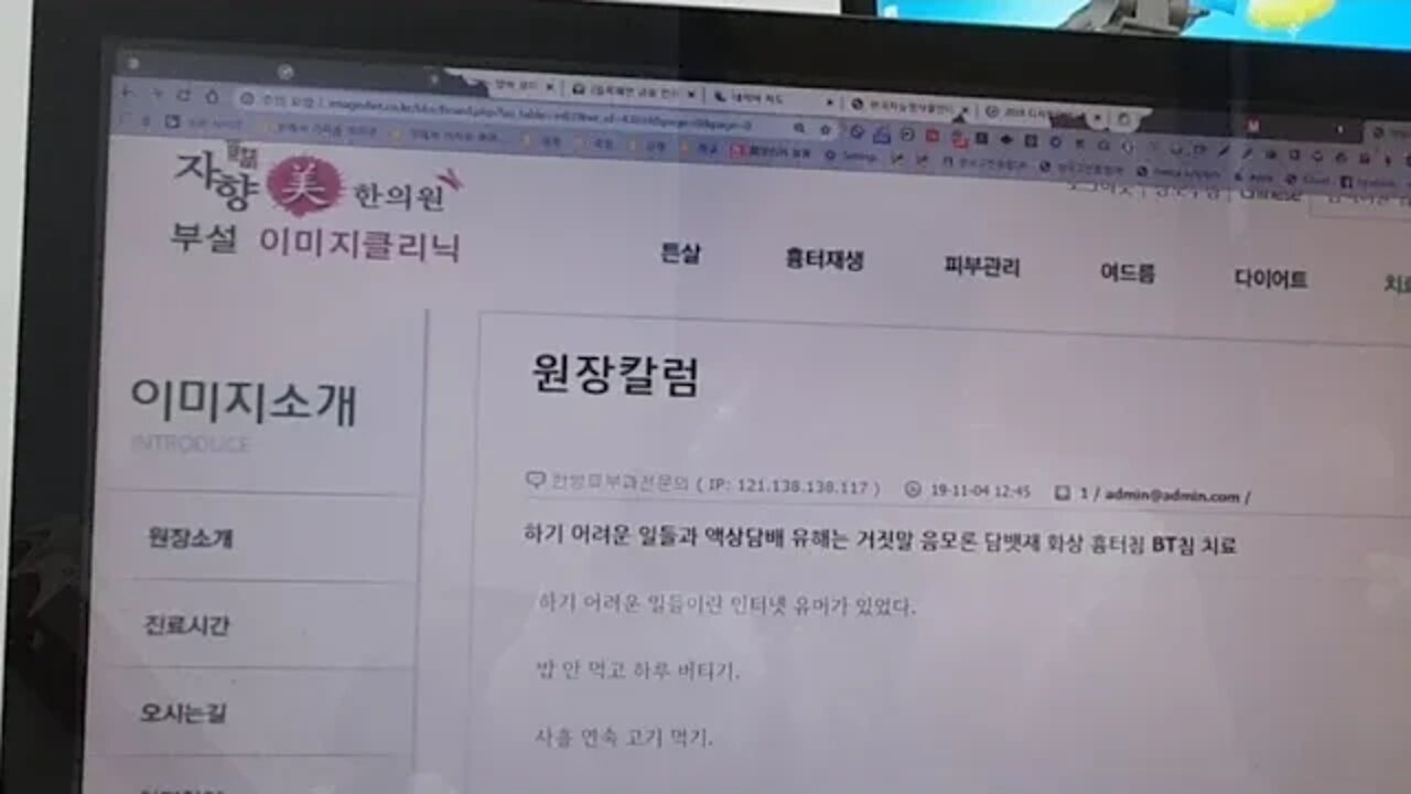 하기 어려운 일 유머 액상 담배 유해는 거짓말 음모론 담뱃재 화상 흉터 흉터침 Bt침 치료
