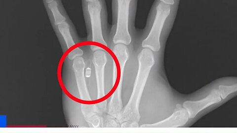 Digital Currency, Digital Id Implanted in your Hand