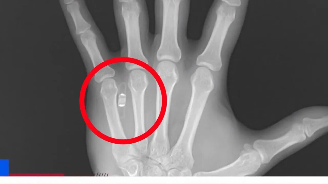 Digital Currency, Digital Id Implanted in your Hand