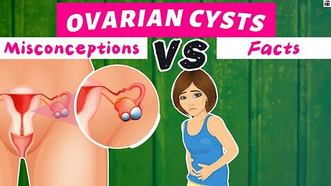 Misconceptions About Ovarian Cysts