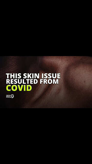 This Skin Issue Resulted From COVID