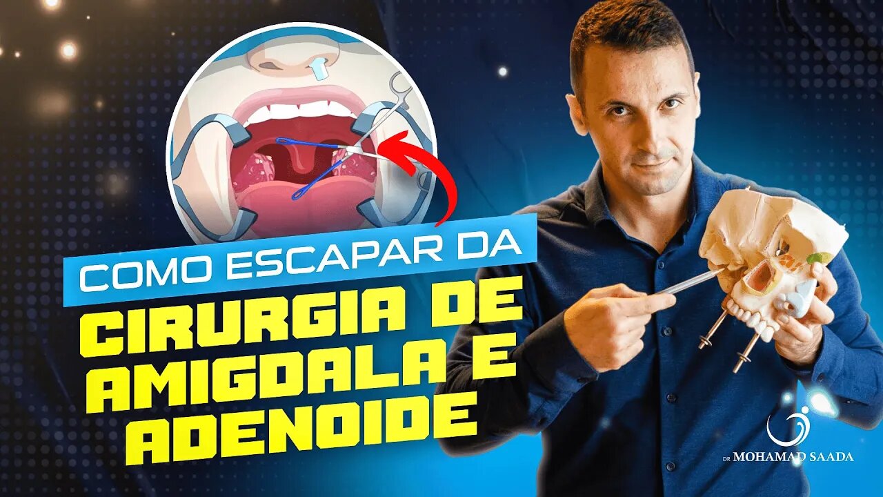 COMO EVITAR A CIRURGIA DE AMIGDALA E ADENOIDE?