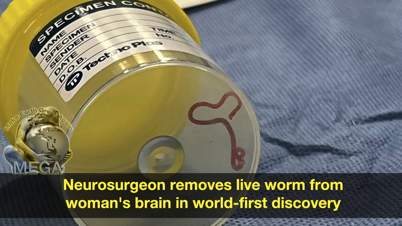 Neurosurgeon removes live worm from woman's brain in world-first discovery | DW News Aug 29, 2023