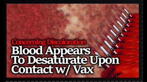 Blood Discoloration! Drs McCairn-Fleming Demonstrate Blood Exposed To Vax Appears Desaturated!