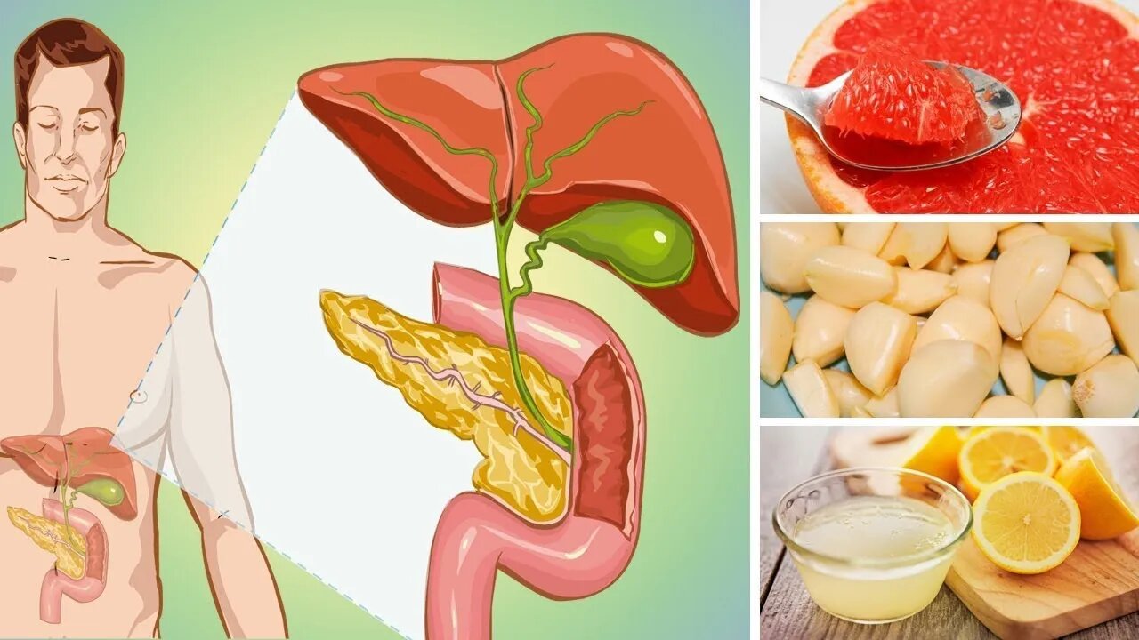 COMA ESTES 6 ALIMENTOS PARA LIMPAR NATURALMENTE O SEU FÍGADO!