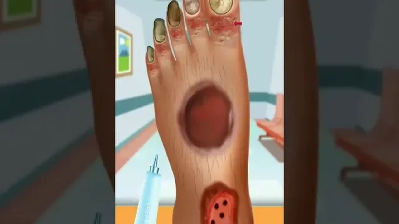 ASMR FOOT TREATMENT ANIMATION#animation #viralvideo #asmr #shortsfeed