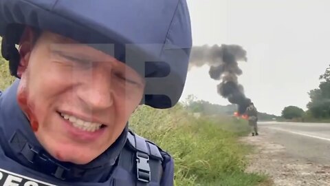 Footage of the TV Center crew, which was injured in an explosion in the Zaporozhye region