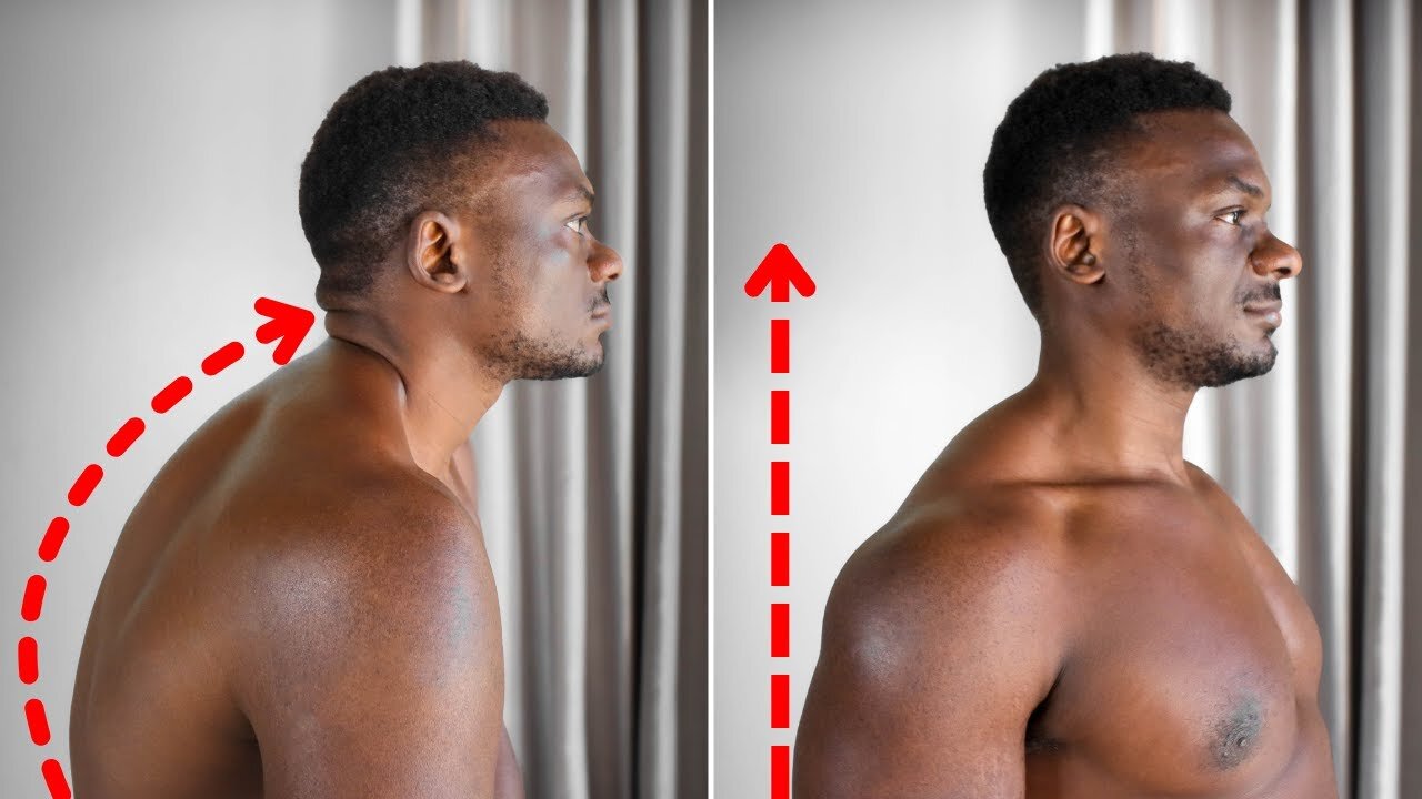 Exercises that Fixed My Terrible Back Posture (Fix Posture and Relieve Back Pain)