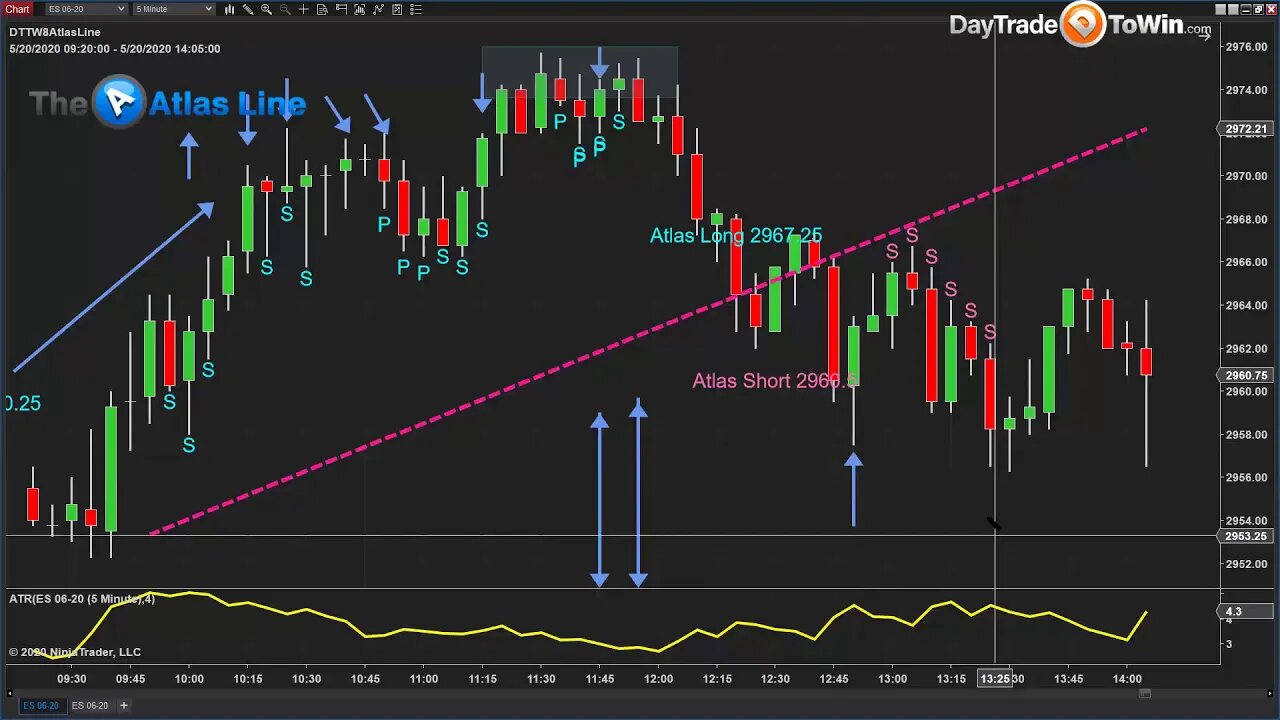 Pick Market Tops and Bottoms Like a Pro with Price Action Trading