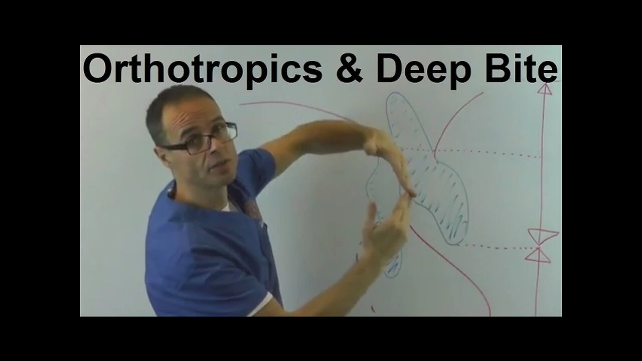 The Effect of Orthotropics on Lower Facial Height on Patients with Deep Bite by Dr Mike Mew