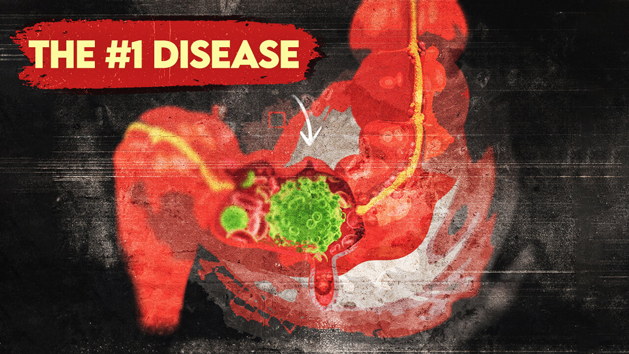 The #1 Disease More Common than Heart Disease and Cancer