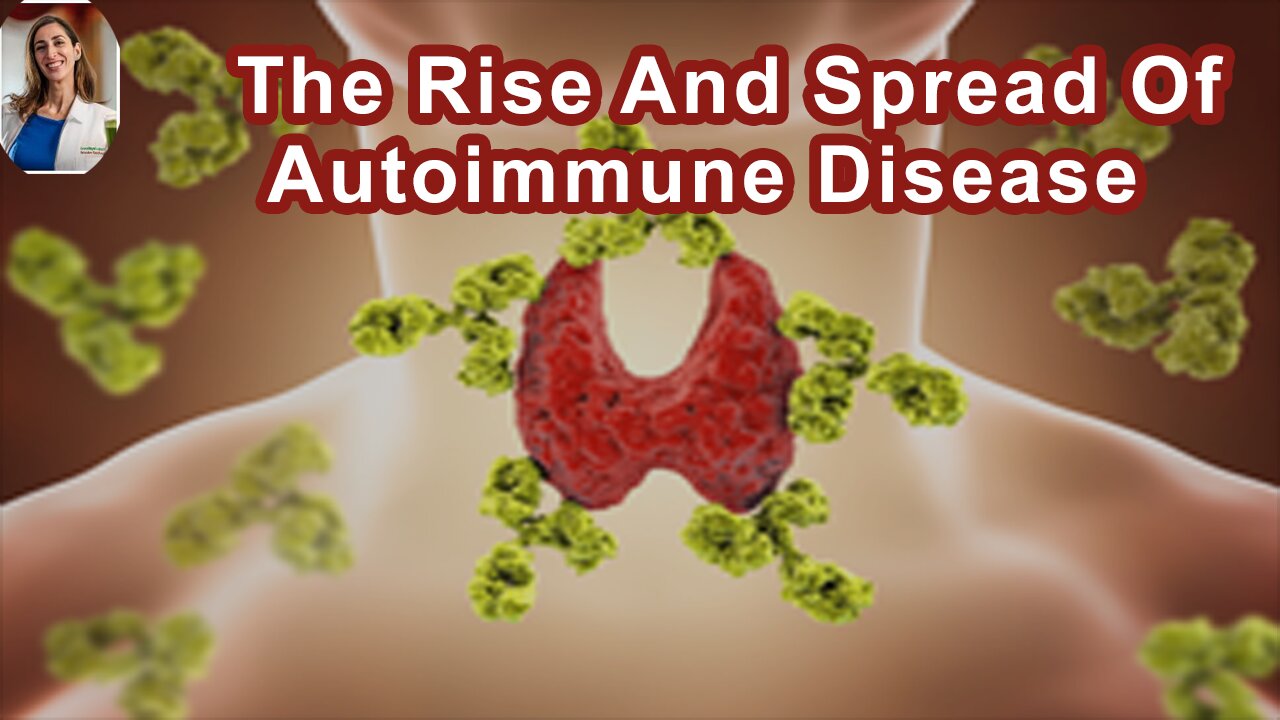 The Rise And Spread Of Autoimmune Disease Has Exactly Mirrored The Rise And Spread Of The Western