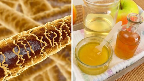 Why You Should Rinse Your Hair With Apple Cider Vinegar and Honey