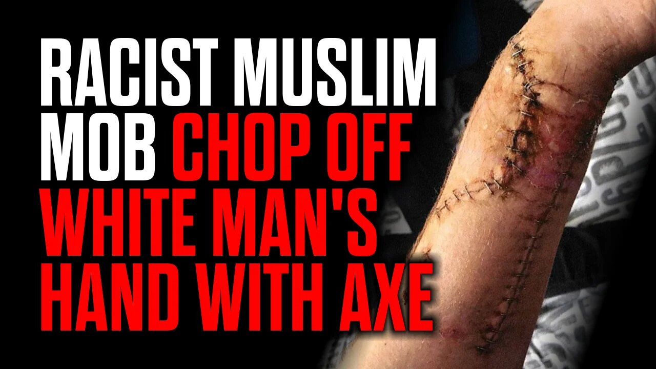 Racist Muslim Mob Chop Off White Man's Hand