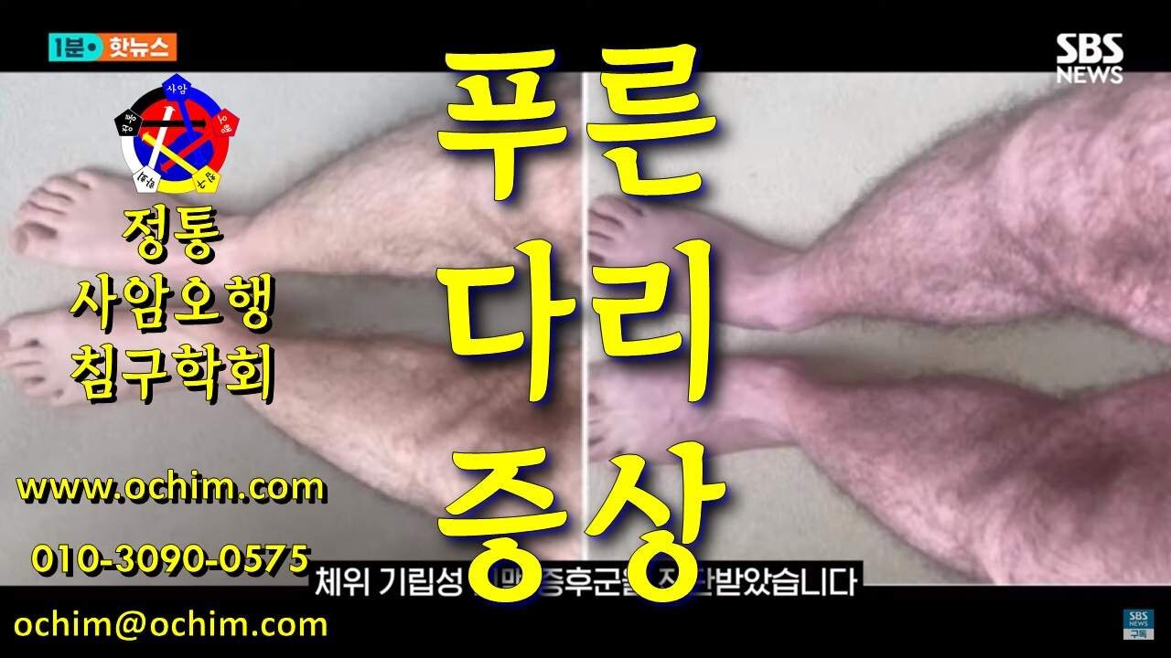 푸른 다리 증상 치료 방법 - 사암침, 사암침법, 정통사암침 - 비과학적 양의학 218