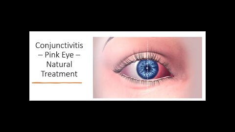 Conjunctivitis Treatment