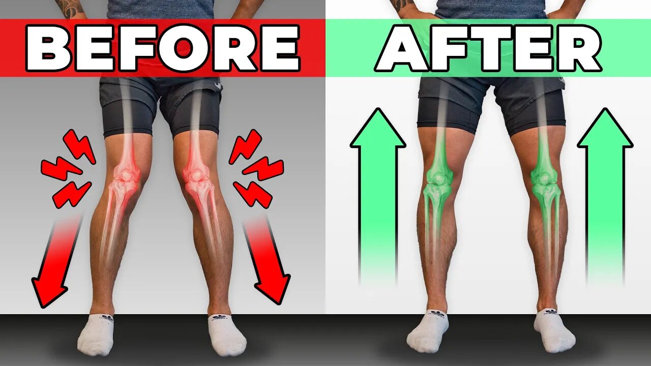 How To Unf-ck Your Knees in 10 Minutes_Day (CORRECTIVE ROUTINE)