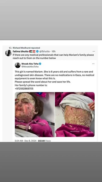 Why does your heart beat?