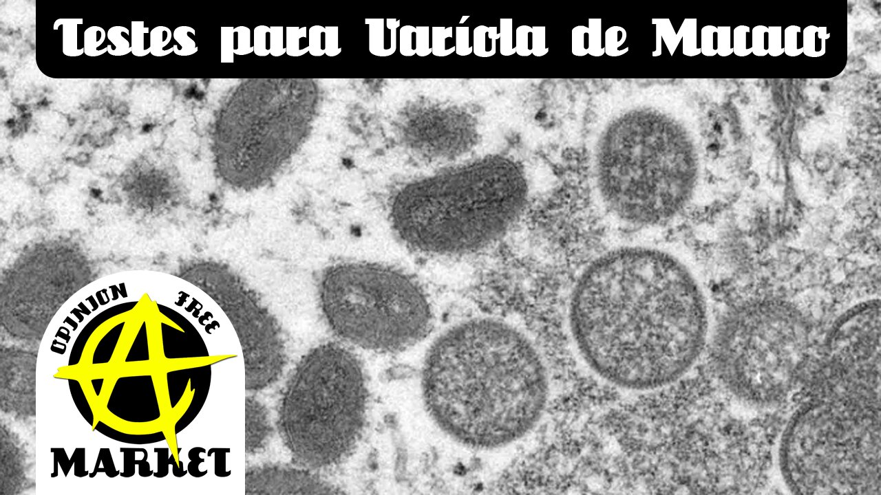 Testes de VARÍOLA DE MACACOS chegam ao BRASIL, pandemínions pulam de ALEGRIA
