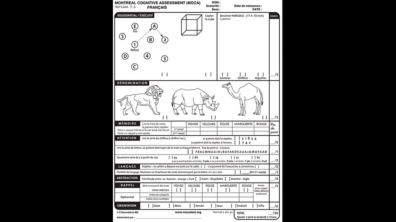 MoCA Test - Instructional Video