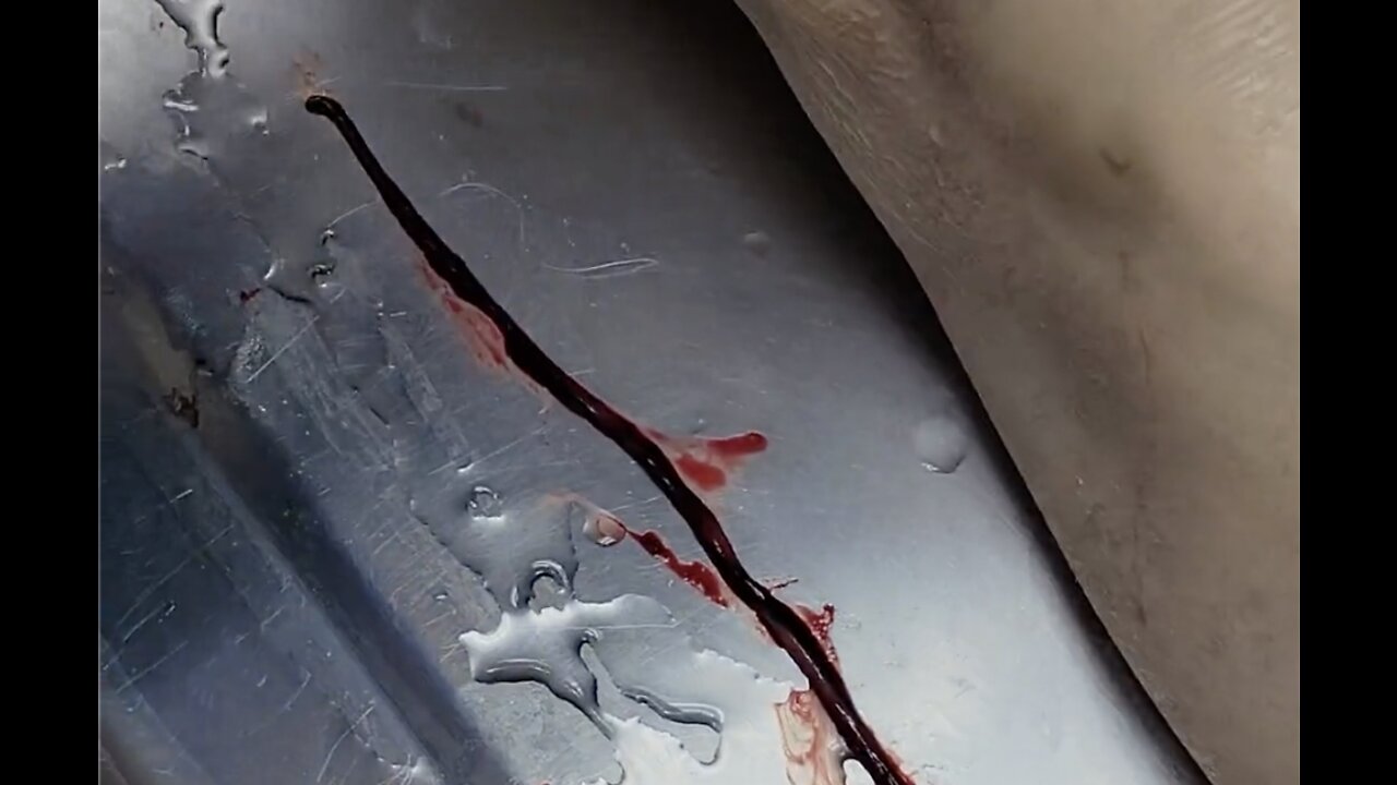 Unbelievable blood clots: video from embalmer Richard Hirschman