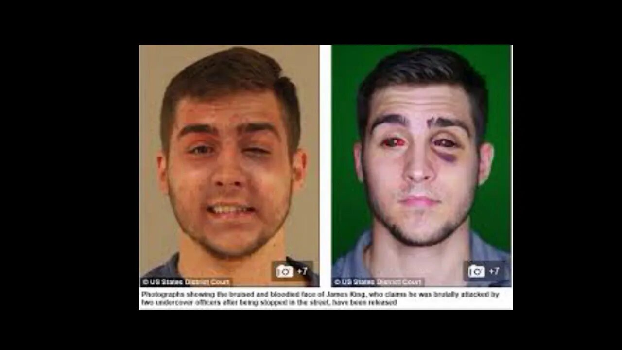 Police Brutality Grand Rapids Michigan