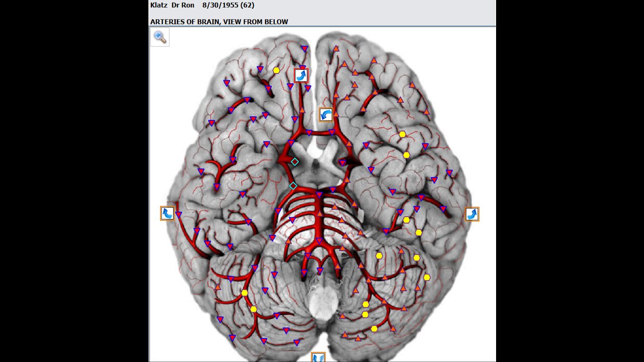 Stroke Recovery Protocols Update Sun Apr 24th 2022