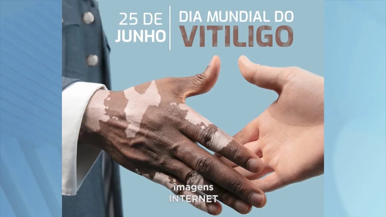 Dia do Vitiligo: conscientização sobre a doença que causa despigmentação da pele