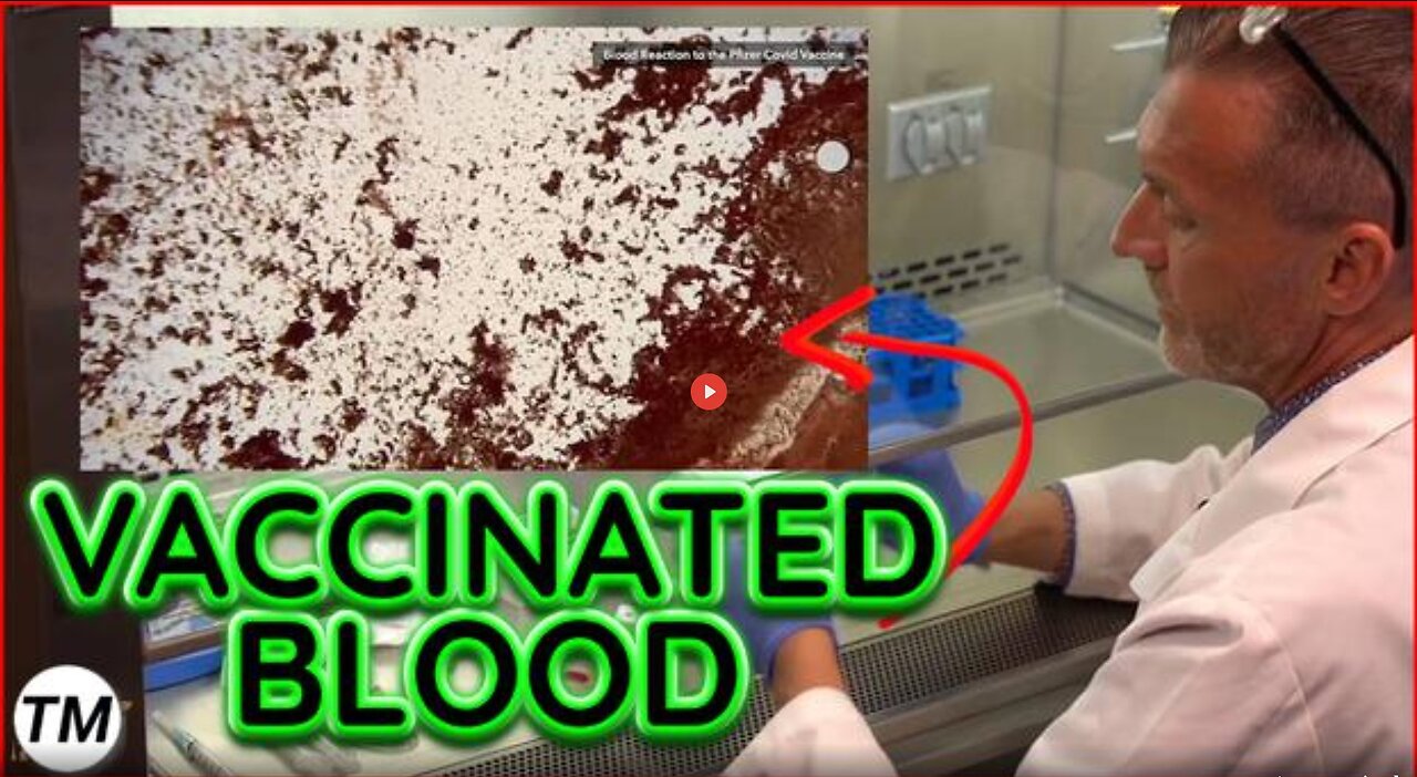 PATHOLOGIST REVEALS WHAT IS REALLY IN THE COVID VACCINES – DR. RYAN COLE