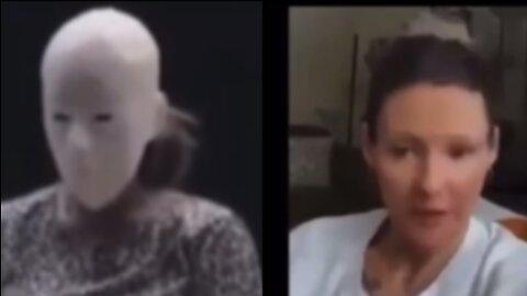 The Shots, So Called Vaccines!