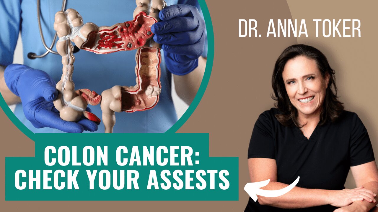 Colon Cancer: Check Your Assets!