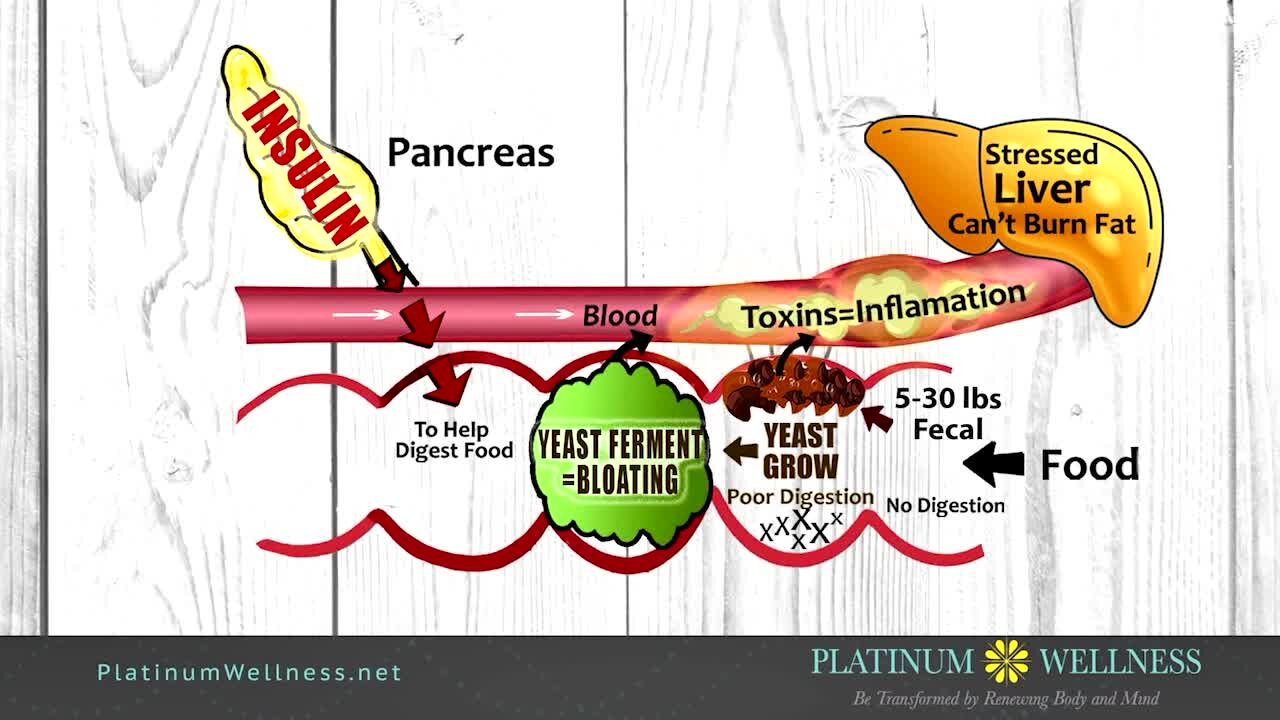 Platinum Wellness: Help you getting to the root cause of weight gain