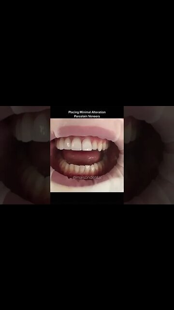 Dental And Teeth Hygiene