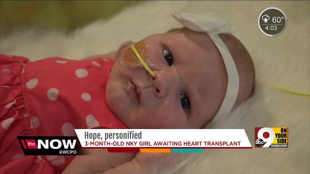 Hope Sansbury, little girl who needs a heart transplant, will dress as Tin Man for Halloween