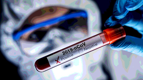 Covid Tests RECALLED: MILLIONS of FALSE POSITIVES