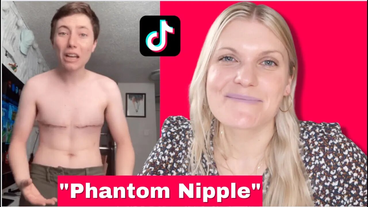 Transgender Experiencing "Phatom Nipple"