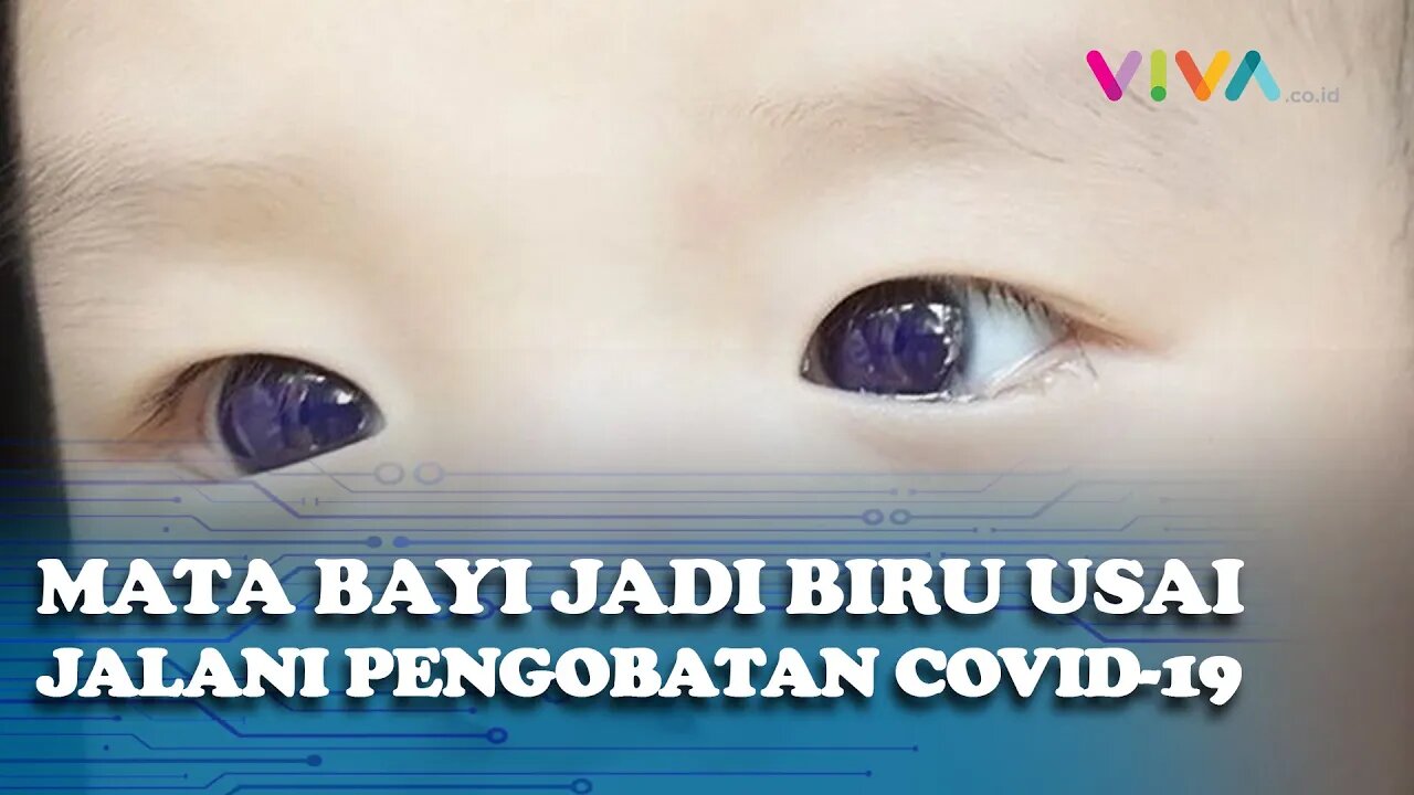 Mata Bayi Berubah Jadi Biru Usai Jalani Pengobatan COVID-19, Kok Bisa?