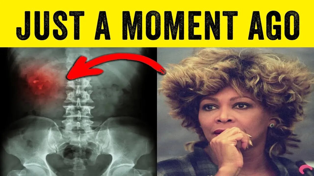 🔴 NEW ANNOUNCEMENT MADE RIGHT NOW ABOUT TINA TURNER