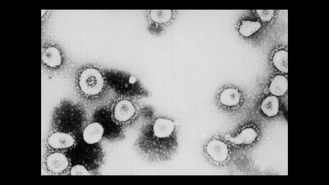 Over 200 people being supervised for possible coronavirus in Nevada, still no confirmed cases in the state