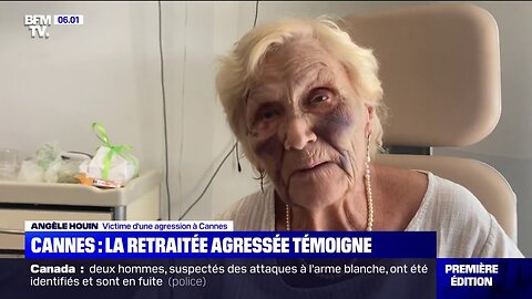 Le Lapin du Futur | Cannes - La retraitée agressée témoigne [Flokossama]