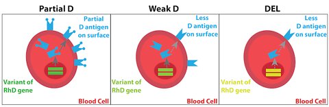 The RH Negative Blood Type: Weak D & Partial D