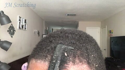 Dandruff Scratching and Removal 2023