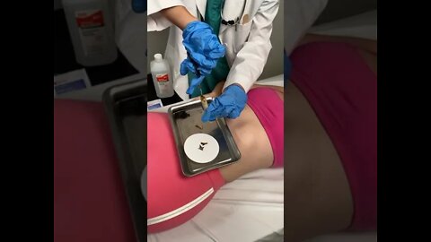 so CRAZY what came out of her BELLY BUTTON! 😱