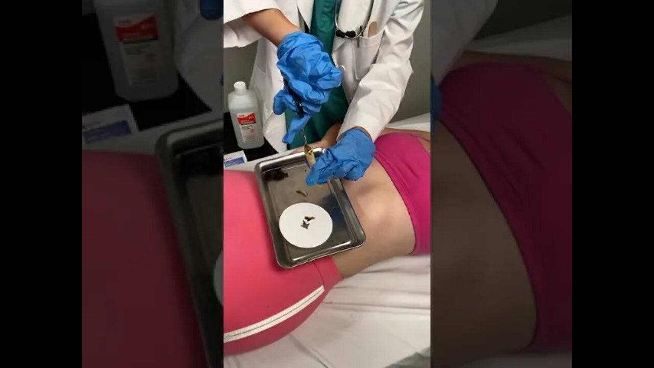 so CRAZY what came out of her BELLY BUTTON! 😱